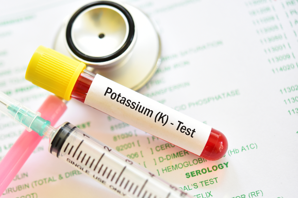 Manque de potassium chez la personne âgée : causes, signes et prévention