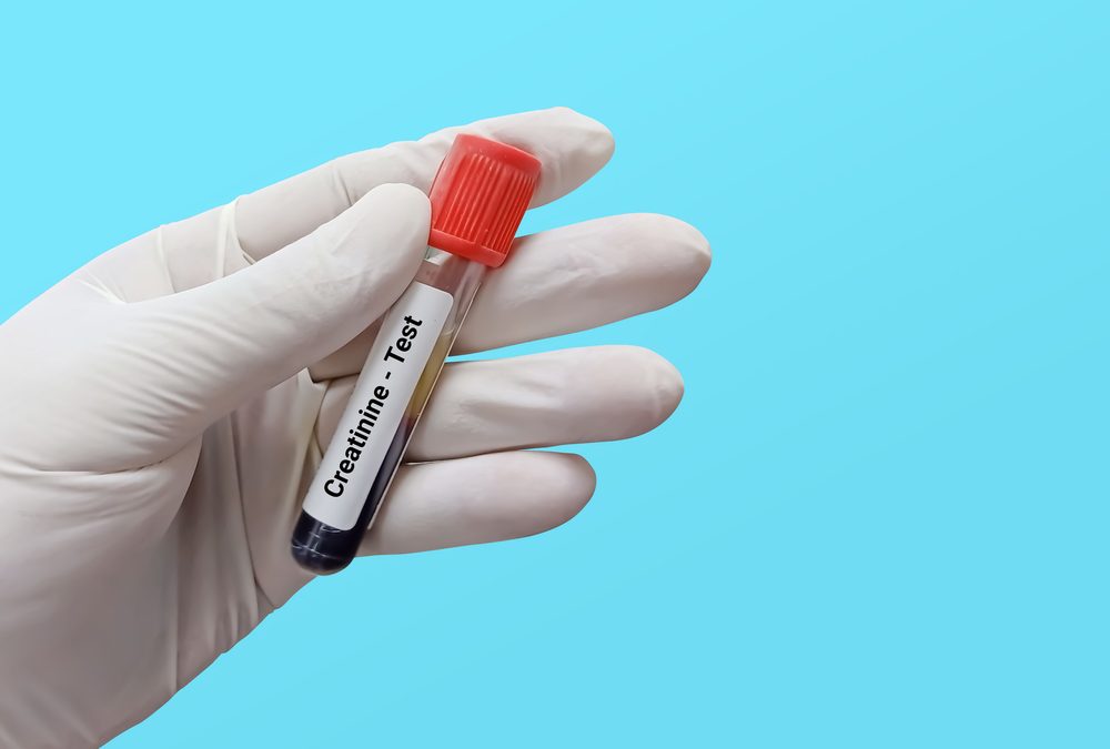 Clairance de la créatinine : ce que les seniors doivent savoir 