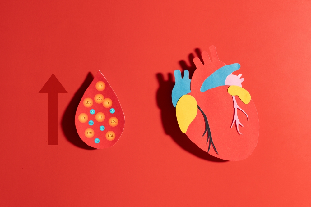 Taux de cholestérol élevé : comment réagir après 60 ans ? 